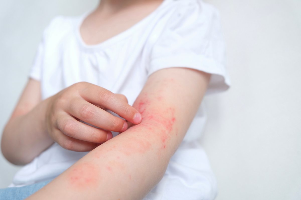 JDP-63-zoom-sur-les-allergies